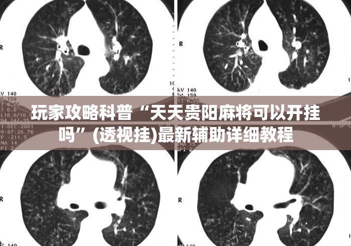 玩家攻略科普“天天贵阳麻将可以开挂吗	”(透视挂)最新辅助详细教程