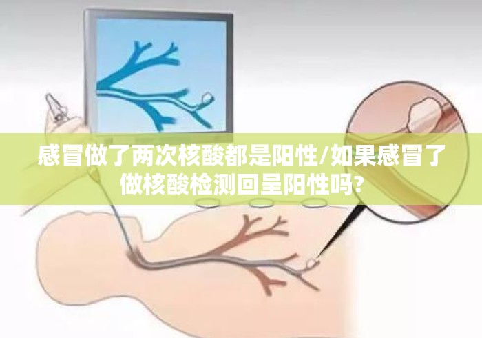 感冒做了两次核酸都是阳性/如果感冒了做核酸检测回呈阳性吗? 感冒做了两次核酸都是阳性/如果感冒了做核酸检测回呈阳性吗?