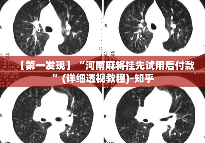 【第一发现】“河南麻将挂先试用后付款”(详细透视教程)-知乎