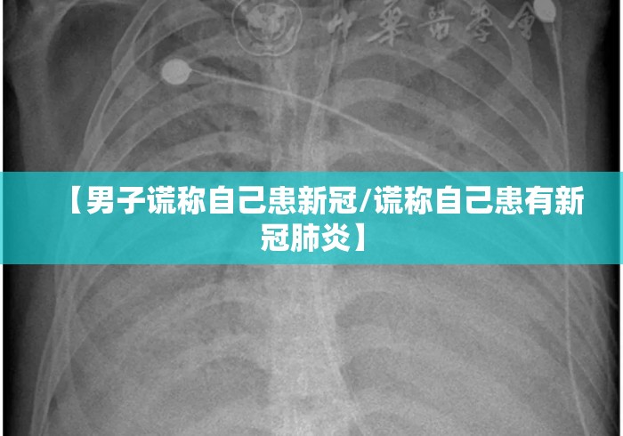 【男子谎称自己患新冠/谎称自己患有新冠肺炎】 【男子谎称自己患新冠/谎称自己患有新冠肺炎】