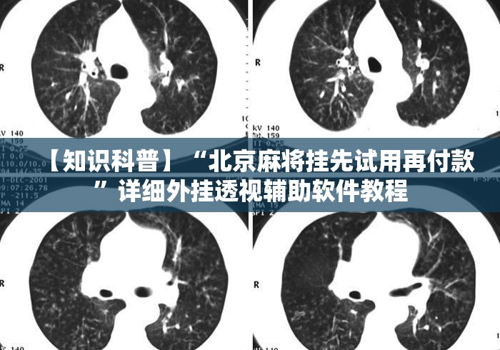 【知识科普】“北京麻将挂先试用再付款”详细外挂透视辅助软件教程
